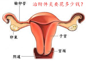 治疗附件炎需要多少钱?